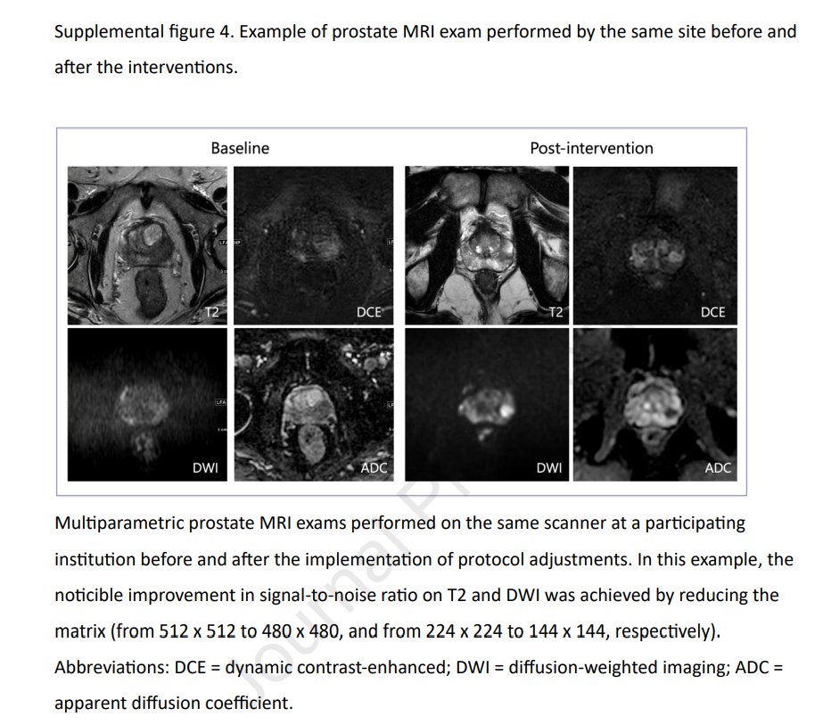 🔔📢I am happy to share this important work lead by @Purysko 'Improving Prostate MR Image Quality in Practice – Initial results from the ACR Prostate MR Image Quality Improvement Collaborative' jacr.org/article/S1546-… @giga_fra @MythreyiC @larson_david_b @RadiologyACR