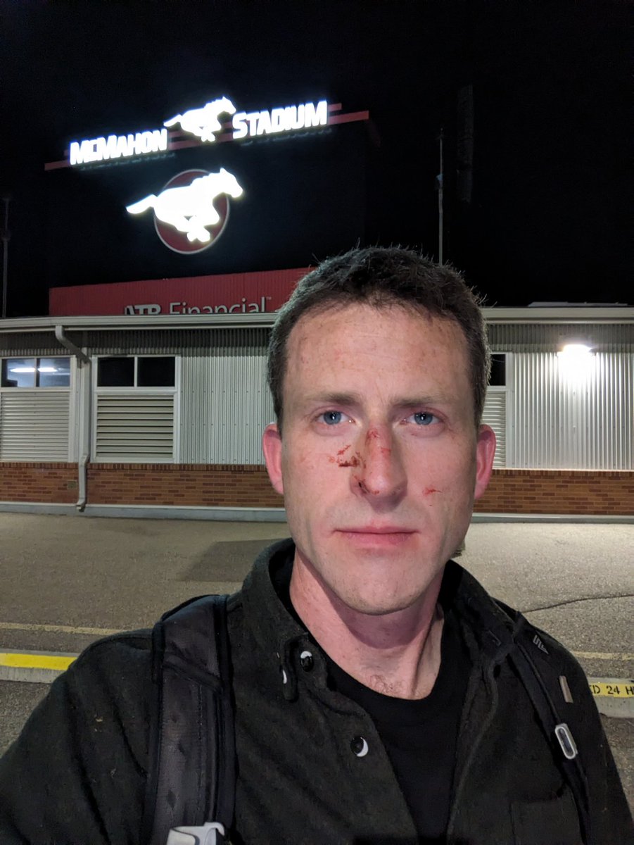 Reposting w/ correction: Taken moments after being released by Calgary Police at McMahon Stadium, owned by *UCalgary* and used as staging ground for assault by CPS on UCalgary freedom of expression on behalf of university admin. Facial injuries: multiple punches to head by CPS.