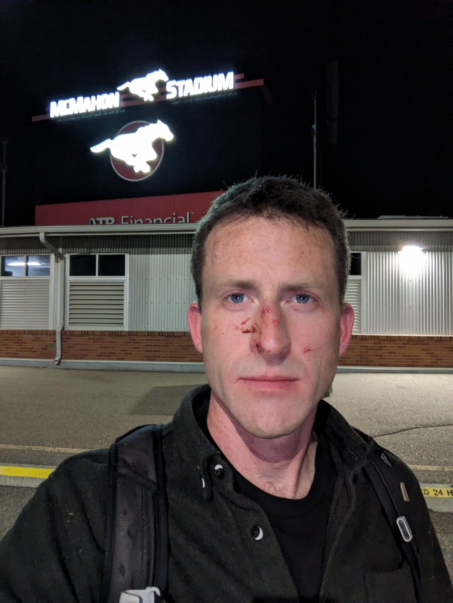 Reposting w/ correction:
Taken moments after being released by Calgary Police at McMahon Stadium, owned by *UCalgary* and used as staging ground for assault by CPS on UCalgary freedom of expression on behalf of university admin.
Facial injuries: multiple punches to head by CPS.