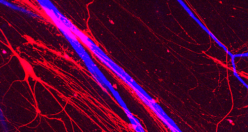 ENG Faculty Anna Devor (BME), Martin Thunemann (BME), and Tim O'Shea (BME, MSE) featured for work at the BU Neurophotonic Center spr.ly/6010jJy9n @BU_BME @BU_MSE