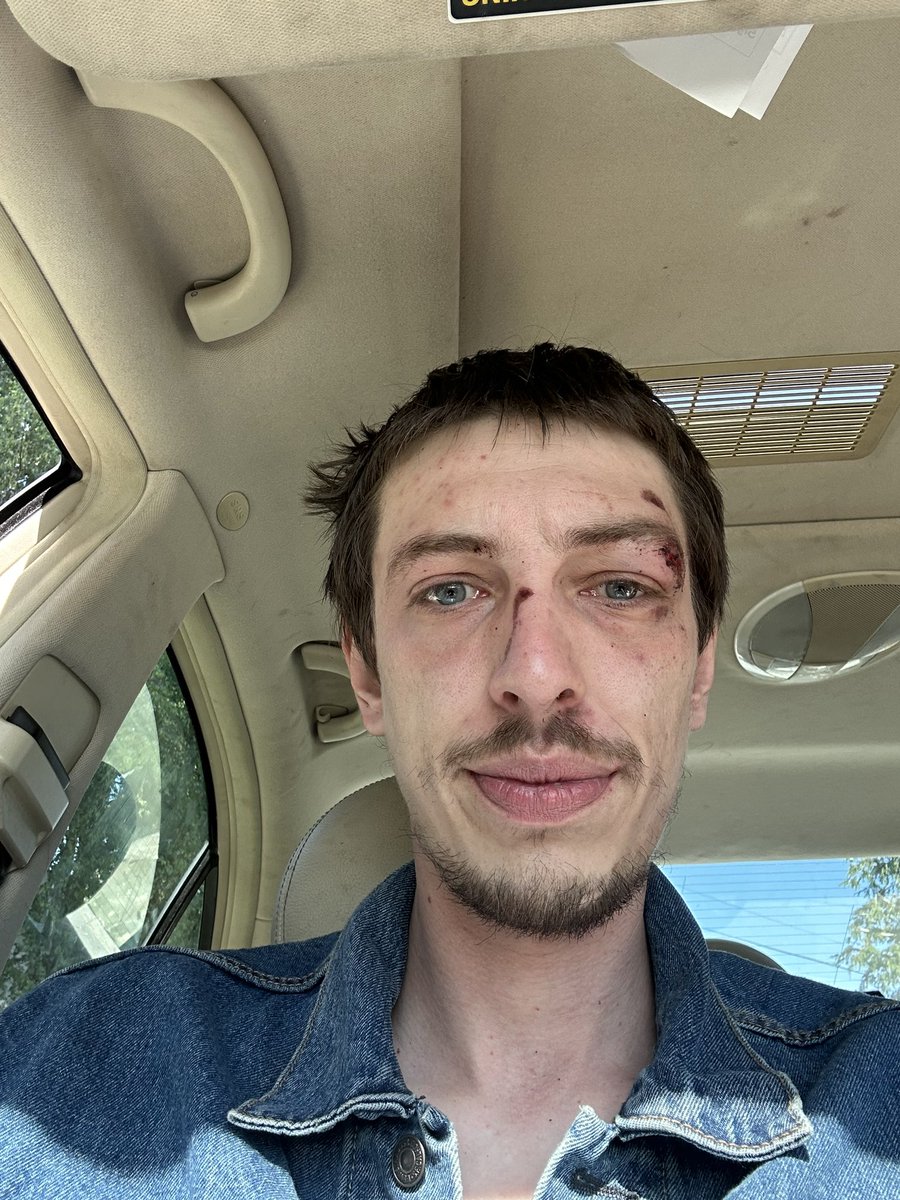 Well this is me. Dirt jumping is harder than it looks. Straight ate shit