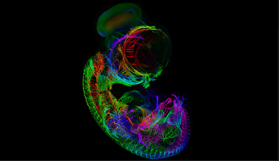 Nervous system of a 7-day old chicken embryo

Source : Martina Schaettin
Dr. Fabian F. Voigt

#Science #microscopy #veterinarian #MedTwitter #MedEd #poultry #neuroscience #neurotwitter