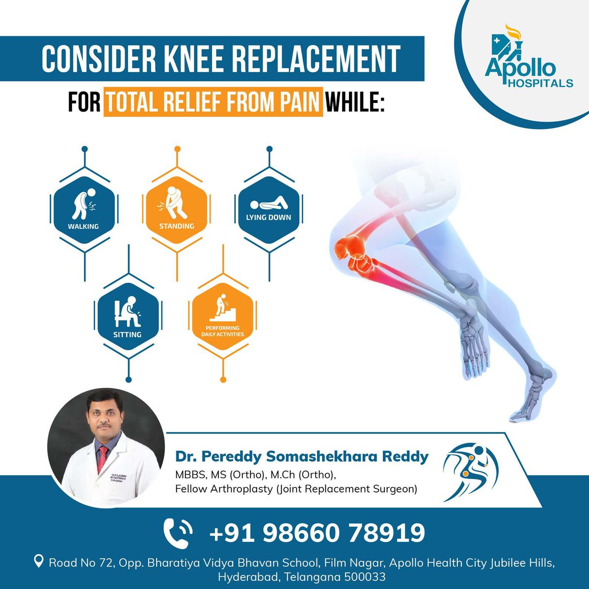 Consider Knee Replacement for Total Relief From Pain While
👉 Lying Down
👉 Walking
👉 Standing
👉 Sitting
👉 Performing Daily Activities

For Appointments:
Call us: +91 98660 78919
#DrPereddySomashekaraReddy #DrSomashekaraReddy #SomashekaraReddy #ApolloHospitals #KneeReplacement