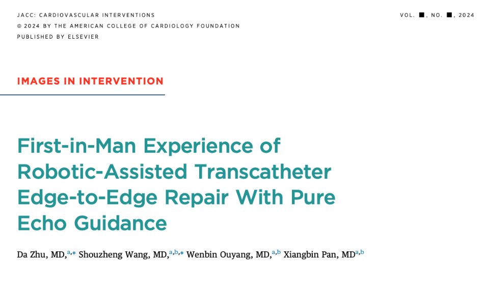 First-in-Man Experience of Robotic-Assisted Transcatheter Edge-to-Edge Repair With Pure Echo Guidance 

🥸 cool work from China: 'pure echo guidance': I am guessing no angiography. 

😱10-point summary 

👇👇