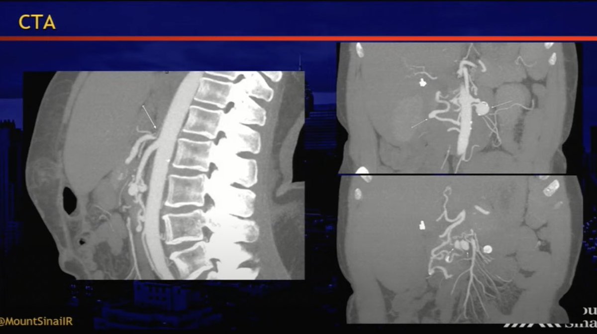 Mount Sinai IR tweet media