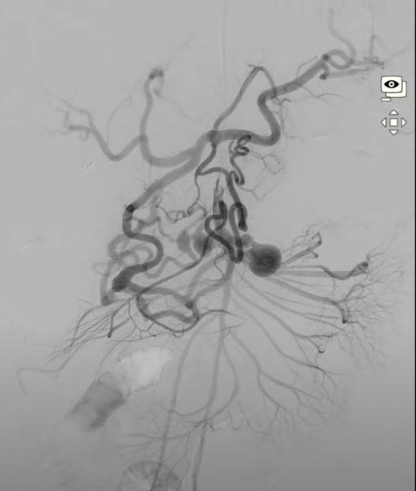 Mount Sinai IR tweet media