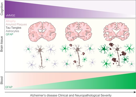 Blood GFAP reflects astrocyte reactivity to Alzheimer’s pathology in post-mortem brain tissue New scientific commentary by Christian Limberger & Eduardo Zimmer tinyurl.com/2354tnwv