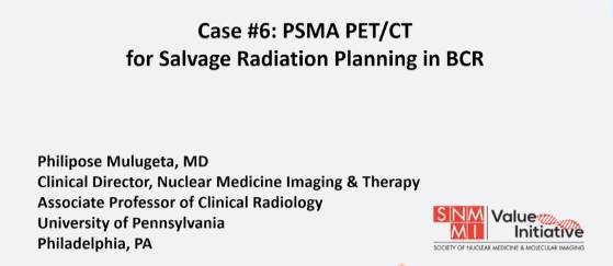 Exciting insights from @phmulugeta! Learn how PSMA PET/CT revolutionizes salvage radiation planning in biochemical recurrence post-prostatectomy. Discover its pivotal role in detecting metastatic disease and guiding personalized treatment strategies @SNM_MI