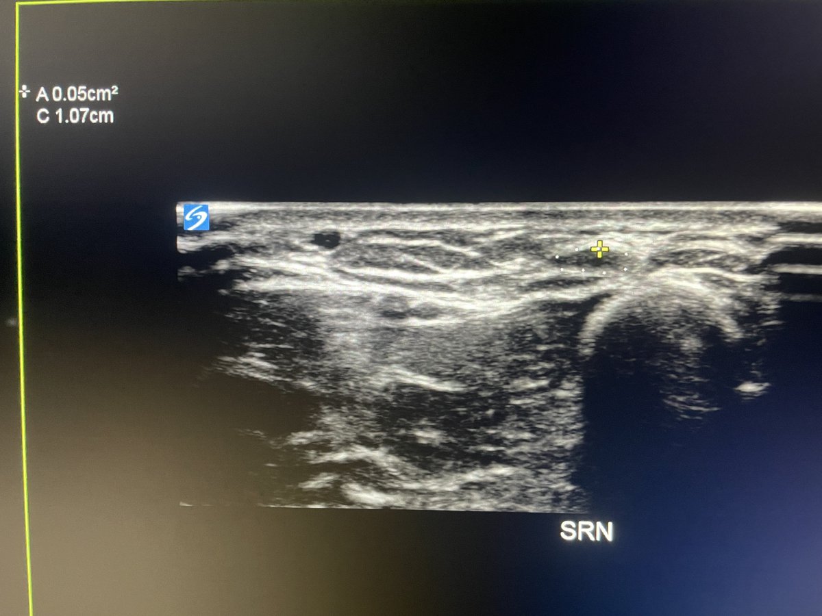 Zach Bailowitz MD, RMSK tweet media