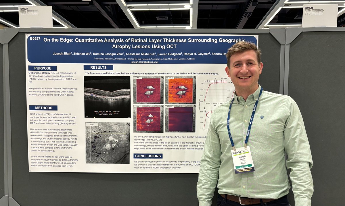 🌟 Wrapping up #ARVO24 with gratitude and inspiration! We had a blast connecting with peers, presenting 5 posters, and celebrating our Series A extension in Seattle! Huge thanks to everyone who made it unforgettable. Let's keep the momentum going! 💫 #AI #eyecare