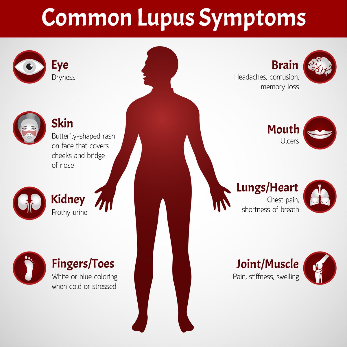 ...
#LupusAwareness #LupusAwarenessMonth #lupusawarenessday #lupus #sle #rheuma #rheumatoid #chronicillness #ChronicPain