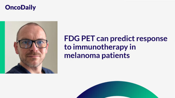 FDG PET can predict response to immunotherapy in melanoma patients - Piotr Wysocki @JagiellonskiUni @CCR_AACR @PennMedicine @BChangMDPhD @EJohnWherry @AmaravadiRavi @FarwellLab oncodaily.com/62977.html #Melanoma #Cancer #CancerResearch #Immunotherapy #OncoDaily #Oncology