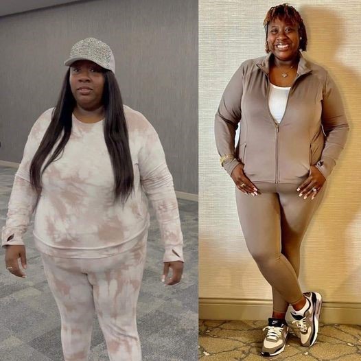 Cheryl's transformation is stunning 😱 From 313 lbs to health & happiness. Dedication + support = incredible change. An inspiration! 💪👏 #HealthJourney #Body-Balancing Drops