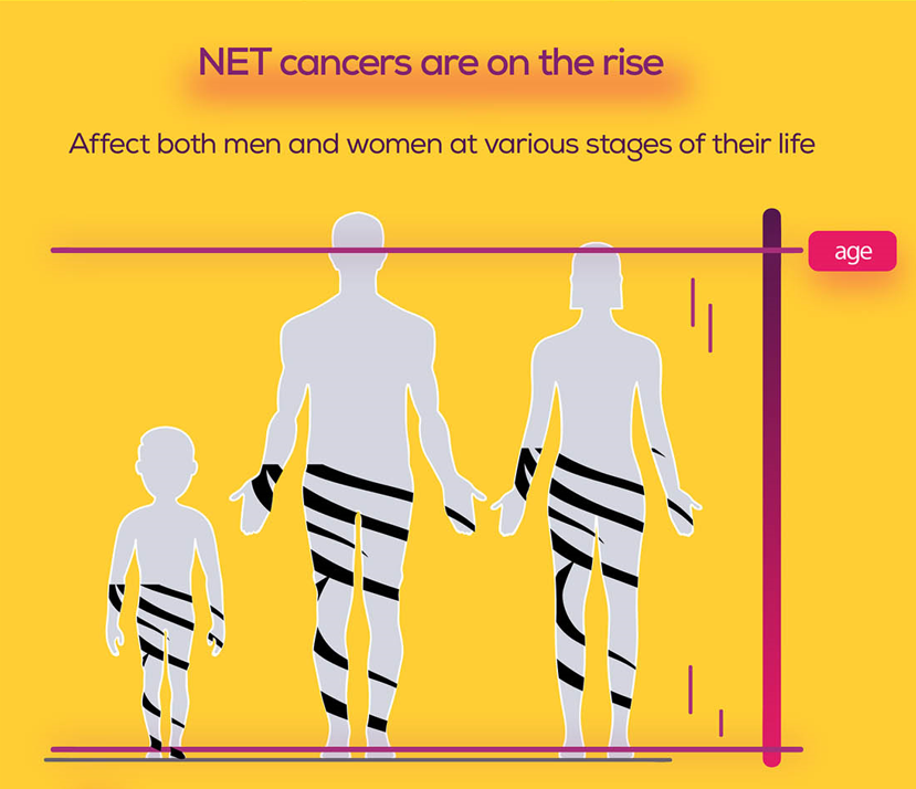 NETs are more common than you think. In prevalence they are more common than pancreatic cancer and patients with myeloma in the population. ☑️We help clinicians to keep NETs on their radar with #NETInfo in 11 languages: incalliance.org/net-info-packs/ #LetsTalkAboutNETs #MedTwitter