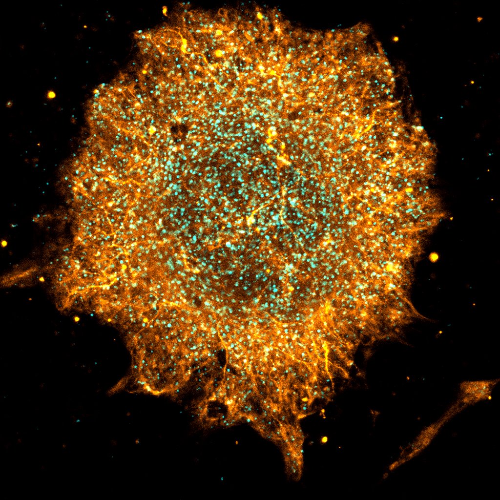 Here's a sunny neurosphere to kick off the weekend after a very Summery #FluorescenceFriday in Dublin . I'm using 3D-printed conductive biomaterials and electric fields to enhance axonal growth from stem cell spheroids. Looks like it's working! #neuroscience #bioengineering