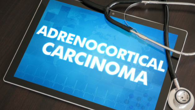 #AdrenocorticalCarcinoma (#ACC) may cause secretion of hormones that a healthy adrenal would not normally produce, such as testosterone and estradiol. ✅Let’s support HCPs with #NETInfo on ACC in 11 languages: incalliance.org/net-info-packs/ #LetsTalkAboutNETs #EndoTwitter