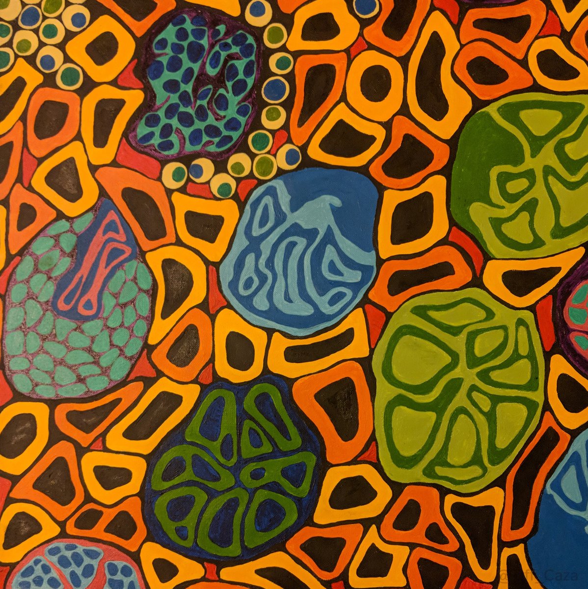 In honor of #WorldLupusDay, we want to share this painting by @Tiff_Caza. It shows features of a proliferative glomerulonephritis.  Endocapillary proliferation, crescent formation, and segmental sclerosis is shown.  These findings can be seen in focal or diffuse lupus nephritis,