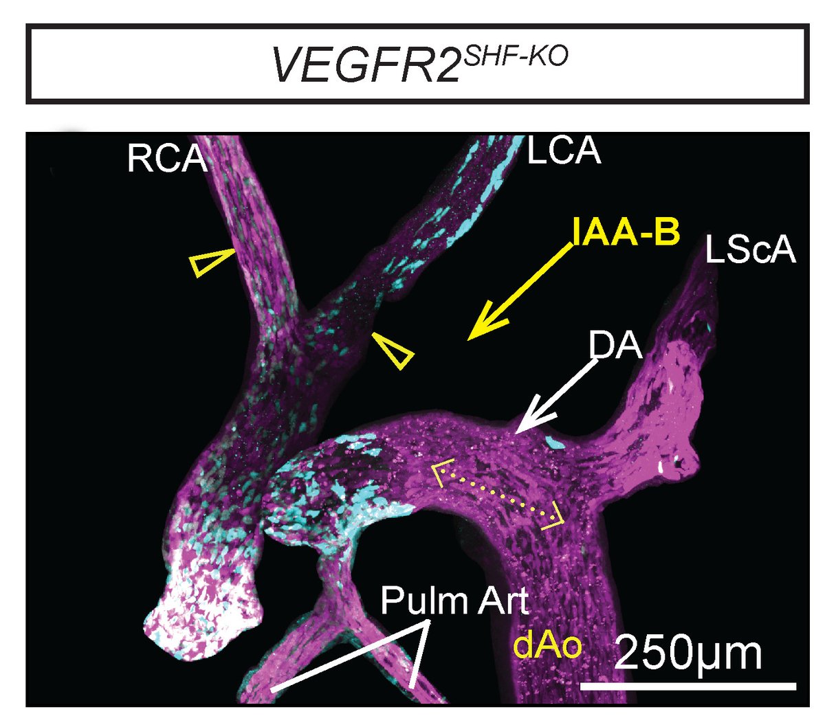 Ramirez et al provides valuable insights into the resilience of developmental mechanisms, shedding light on the robustness & plasticity involved in the development of #PAA-derived #vasculature. Learn more at found at ahajrnls.org/3QDHzBk @sophie_astrof