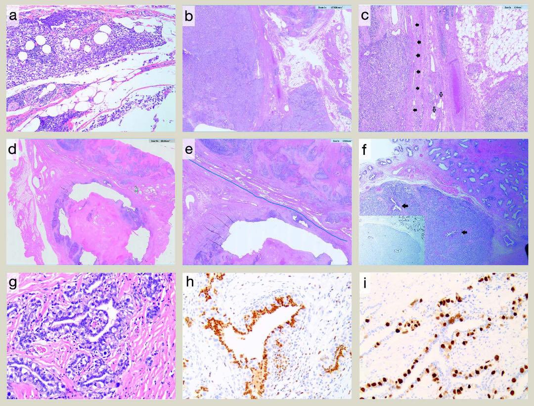 Liang Cheng, MD tweet media