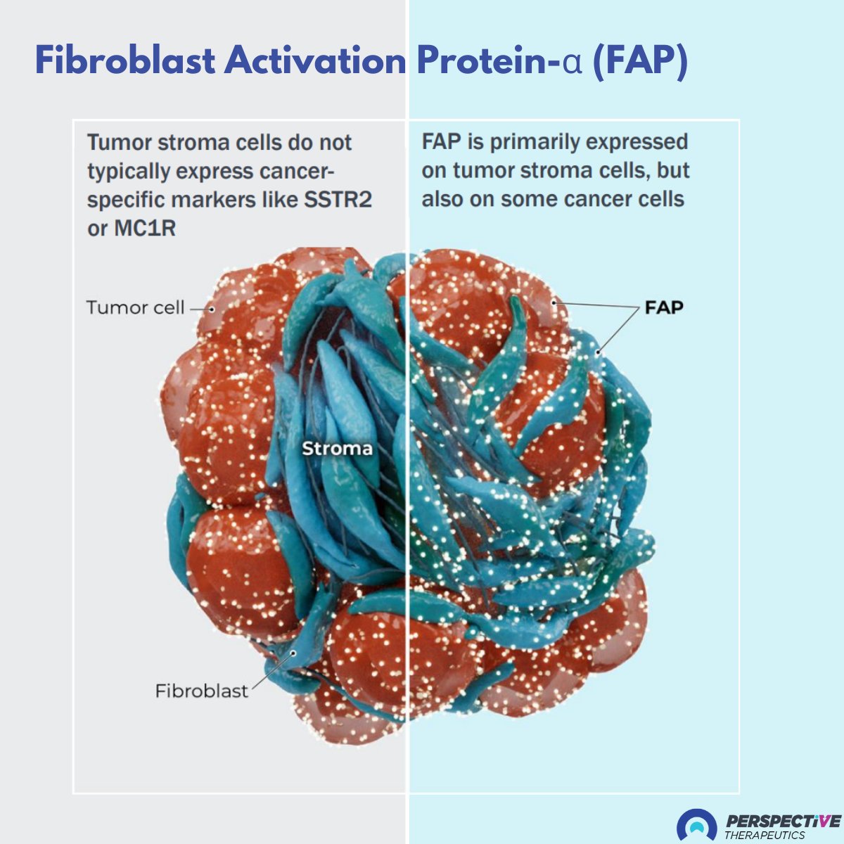 Did you know - Fibroblast Activation Protein-α (FAP) is a potential game-changer in #cancer therapy? Primarily expressed on tumor stroma cells, FAP represents a promising target across multiple cancer types. 

perspectivetherapeutics.com

#nuclearmedicine #radiopharma #oncology