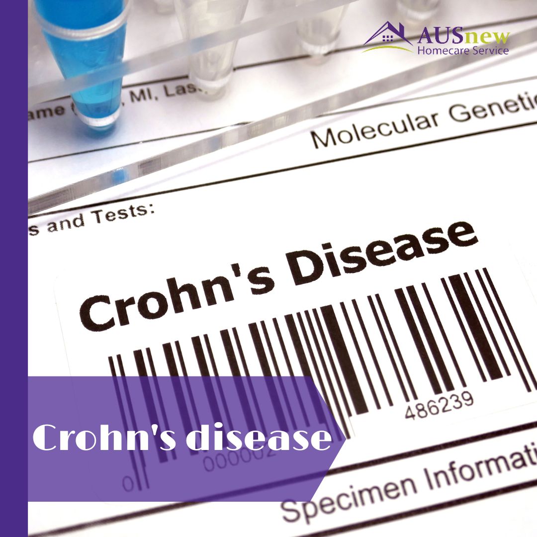 💠Inflammatory bowel illness includes Crohn's. It causes intestinal inflammation, which can cause severe diarrhoea, tiredness, weight loss, and malnutrition. Source: Mayo Clinic #nflammatoryboweldisease #crohnsdisease