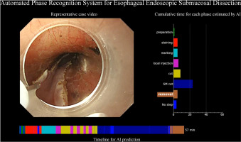 In New Methods, Furube et al showcase an 'Automated artificial intelligence–based phase-recognition system for esophageal endoscopic submucosal dissection (with video).' giejournal.org/article/S0016-… @Stentingwoman