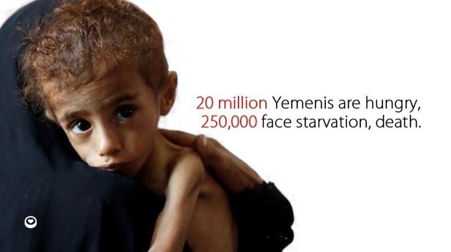 #Yemen🇾🇪
#StandUpForYemen
#StopStarvingYemeniChildren
#StopAllWars
#HelpSyria 
#FreePalestine🇵🇸
#EndIsraelsGenocide