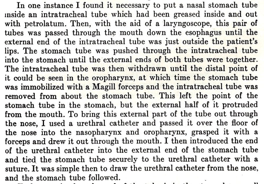Insertion of gastric tubes during anesthesia can sometimes present a problem. Lundy described his method in 1945 (image from his book). But removal of the ET tube can be impossible when the proximal end of the gastric tube is enlarged.