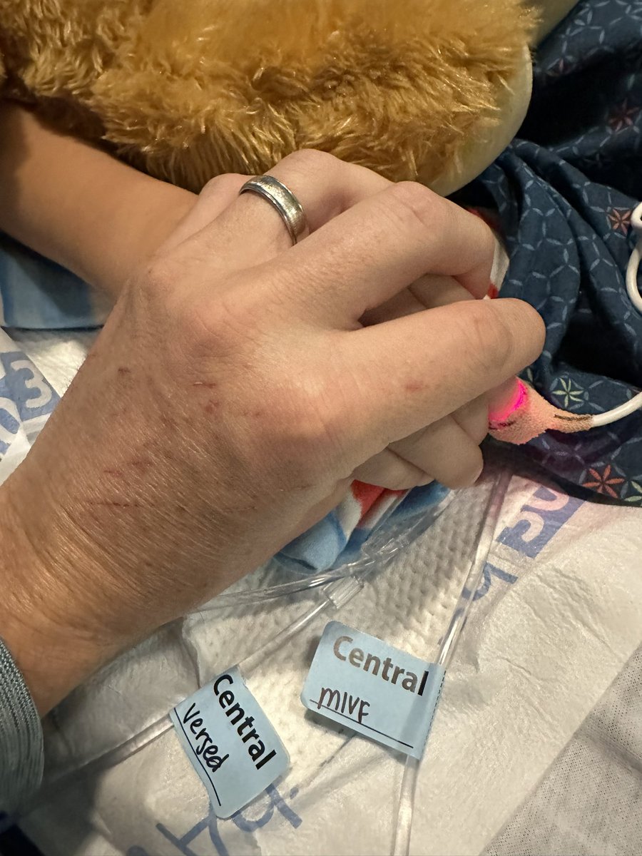 12:00pm: please respect our and the hospitals privacy. 

The doctor this morning told us Asher wouldn’t survive his injuries. Neurology saw a few signs (small response to pain in one arm, and pupils reacting to light) of activity a little while ago so we aren’t giving up hope.