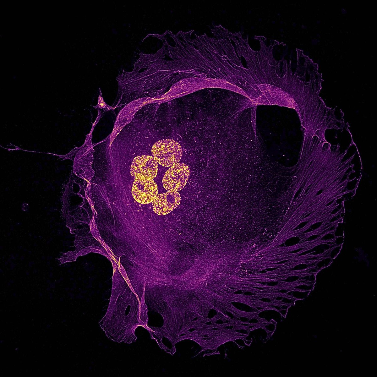 Happy #FluorescenceFriday ! Below is a breast cancer cell stained for actin in magenta and nuclei in yellow!