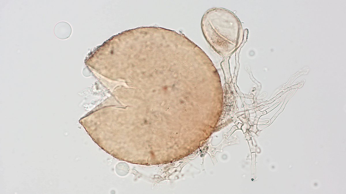 Win the lottery is good...but get a pure culture of Corymbiglomus globiferum is priceless. Species isolated from sand dunes in southern Brazil by Karl Kemmelmeier and part of the International Culture Collection of Glomeromycota (CICG).