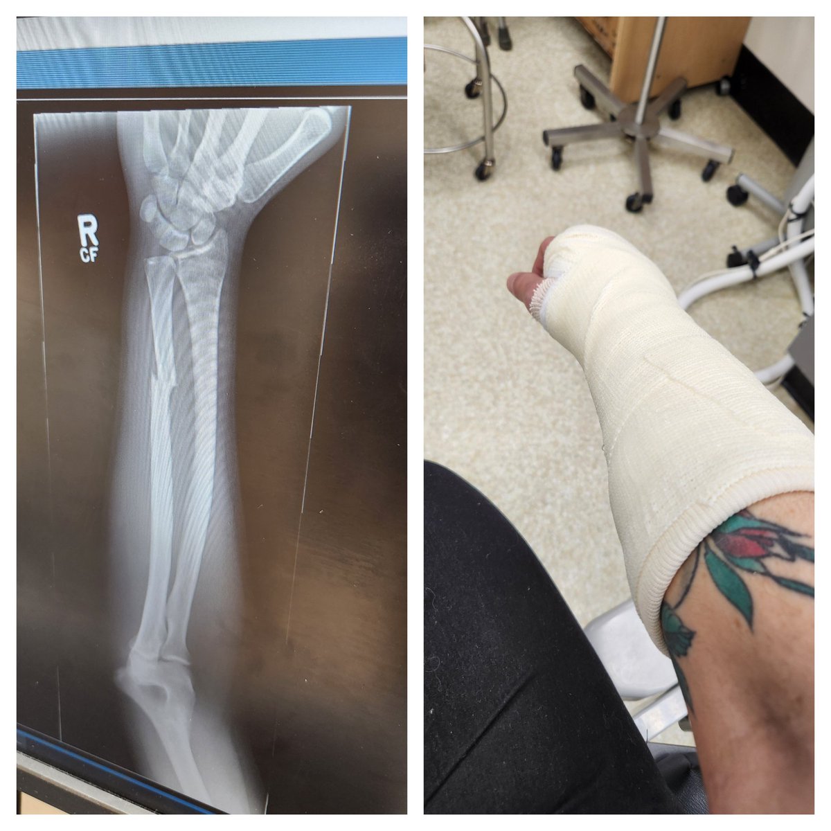 I've been in pits with baseball bats, flying mattresses, HA members, and European mosh crews and have been fine.

Decided to come out of mosh retirement during the <a href="/syscband/">SeeYouSpaceCowboy</a> set and got a clean break on the forearm. Feeling old af but had a great night lmao