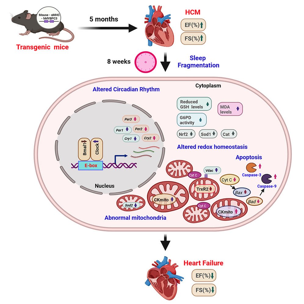 #Sleep fragmentation induces #heartfailure in a hypertrophic cardiomyopathy mouse model by altering redox #metabolism sciencedirect.com/science/articl…