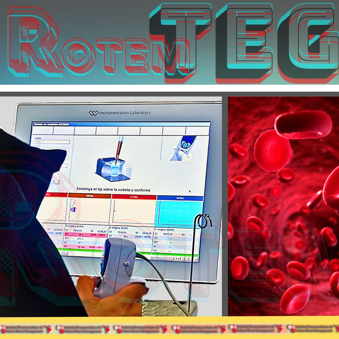 El impacto de TEG y Rotem como predictores tempranos en el diagnóstico de hemorragia. 
La implementación de programas #PatientBloodManagement en los hospitales, ha llevado a una participación cada vez mayor de los especialistas en medicina transfusional en la toma de decisiones.