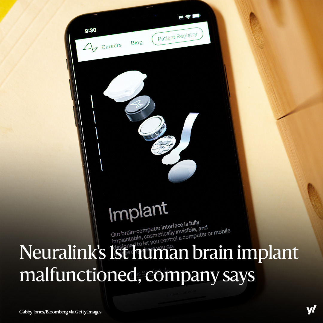 The first Neuralink implant in a human malfunctioned after several threads recording neural activity retracted from the brain. While the problem doesn’t appear to pose a risk to the test subject's safety, Neuralink reportedly floated the idea of removing the implant.…