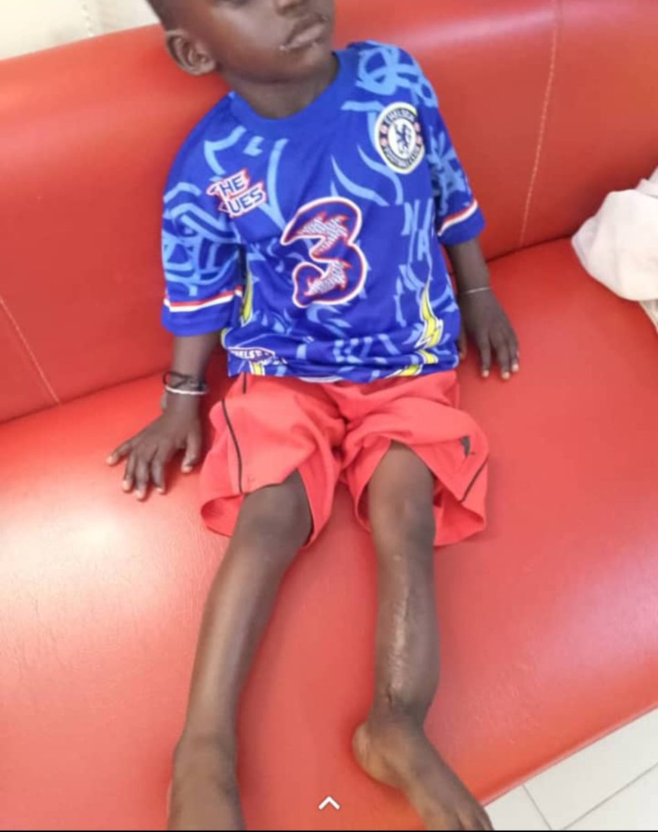 Makhfouss2's tweet image. 🚨URGENCE 🚨

Cette doit doit faire une opération. Sa famille n’a pas les moyens et sa mère tombe souvent malade. Nous comptons sur vous pour soigner sa jambe .

Besoin de : 700.000 F
Somme collecté pour l’instant: 173.000 F. Niou Diap ci 🫶🏾

🚨Orange Money / Wave : 77 795 27 42