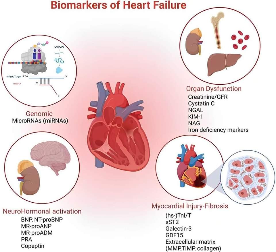 🔴 Heart Failure: Is There an Ideal Biomarker?📝 #2023Review #openaccess 

imrpress.com/journal/RCM/24…
#Heart_Failure #HF #Biomarker #pathophysiology #natriuretic_peptides #hs_cTnT