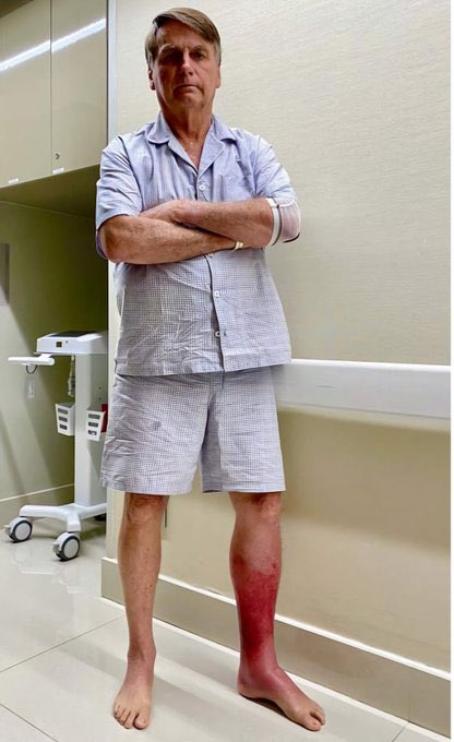 NP__Oficial's tweet photo. 🚨 Veja: l Há um mês, evangélicos oravam e ungiam a perna de Bolsonaro. De lá pra cá, a erisipela só piorou https://t.co/Ig9cJKuOXf