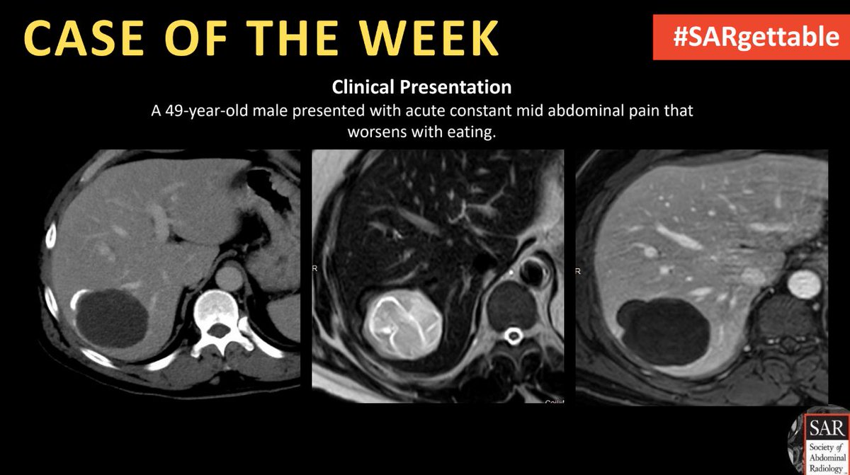 It's time for a new #SARgettable case of the week contributed by Dr. Lucy Muinov and Will Roeder. Comment with your diagnosis down below!