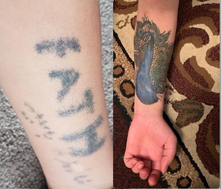 This Yezidi woman was kidnapped by ISIS terrorists. She was tortured,raped and sold. lSlS terrorist carved his name on her arm to claim her as his ‘property’. After she escaped,she got a peacock, the symbol of the Yezidi religion, tattooed on her arm. 2703 Yezidis still missing