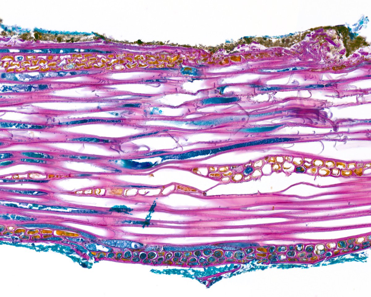 Use PAS-D to turn a splinter into a MOMA masterpiece