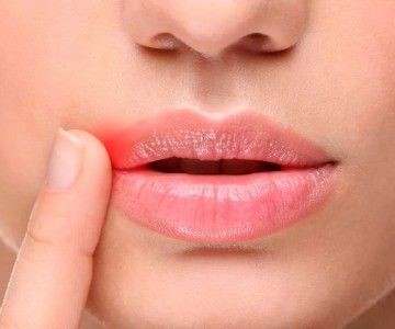 Modymurce's tweet photo. membantu mencerahkan warna bibir memudarkan warna hitam ~Lip serum ~ Lip essence ~ Lip Mask ~ Lip treatment

A thread https://t.co/GVHghoYp0D