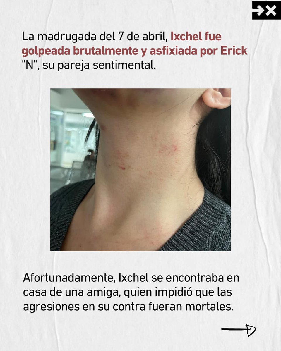 IMUMIDF's tweet image. #JusticiaParaIxchel #JuezLiberaAFeminicida
⚠️ Desde el #IMUMI denunciamos el actuar del Juez José Gabriel Martínez Peña del #TSJCDMX al libera a presunto feminicida, luego de atentar contra la vida de nuestra compañera Ixchel.
📣 Comparte y difunde para que nuestra compañera