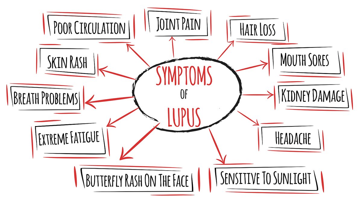 Systemic lupus erythematosus is a chronic condition with symptoms like fatigue, fever, & pain. It commonly presents with skin rashes, kidney issues, & sensitivity to sunlight. #LupusAwareness #LupusAwarenessDay
Image: St. Michael’s Elite Hospital