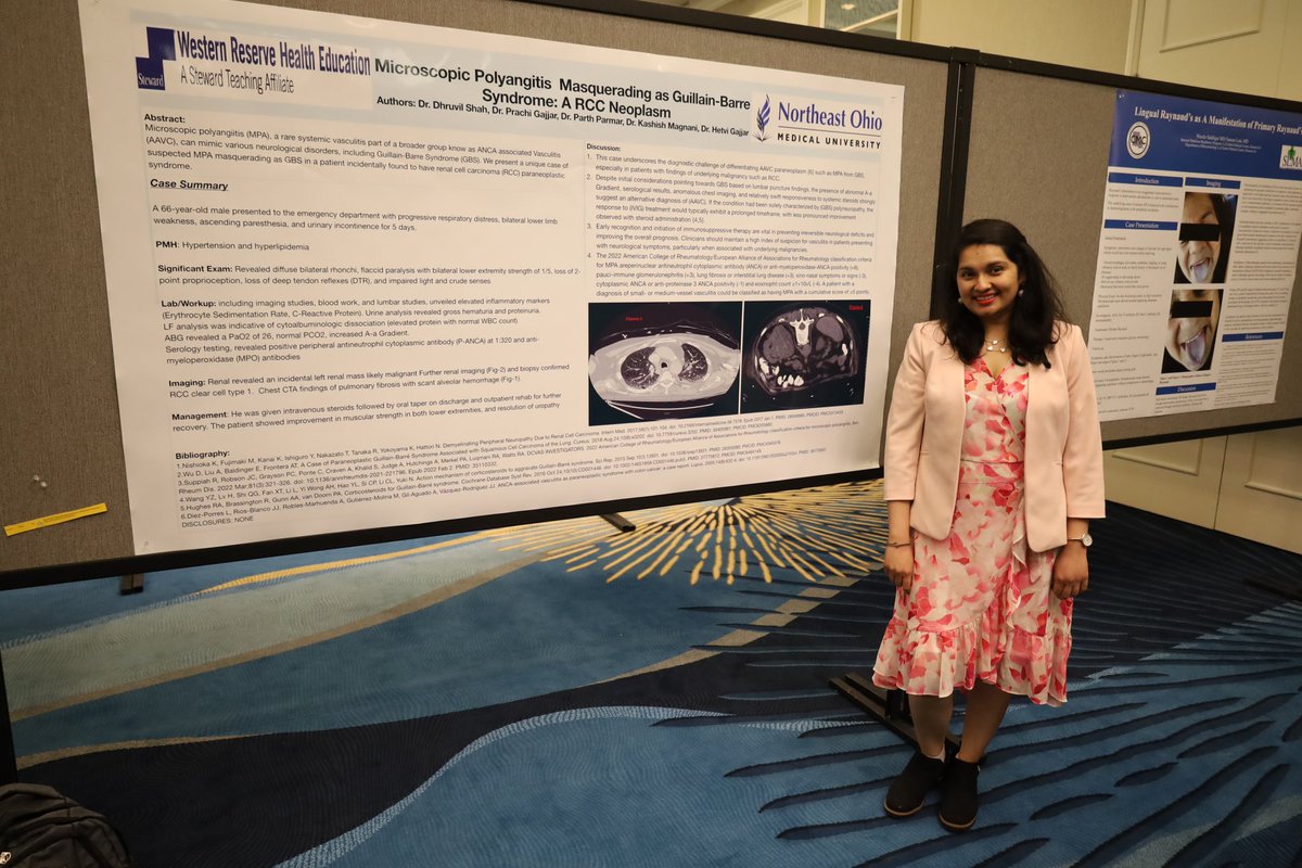 Prachi Gajjar (@gajjarprachi) on Twitter photo It’s time for joints and connective tissues.. Presented 3 posters in two conferences- Clinical congress of rheumatology and New York International rheumatology forum..
Destin, Florida
<a href="/NEOMEDedu/">Northeast Ohio Medical University (NEOMED)</a> <a href="/IM_WRHE/">Internal Medicine WRHE/NEOMED program</a> <a href="/NYRIF/">Rheumatology Forum</a> It’s time for joints and connective tissues.. Presented 3 posters in two conferences- Clinical congress of rheumatology and New York International rheumatology forum..
Destin, Florida
<a href="/NEOMEDedu/">Northeast Ohio Medical University (NEOMED)</a> <a href="/IM_WRHE/">Internal Medicine WRHE/NEOMED program</a> <a href="/NYRIF/">Rheumatology Forum</a>