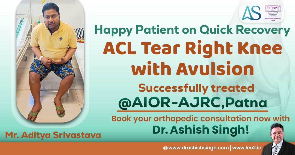 Watch our happy patient Mr. Aditya Srivastava sharing his quick recovery from ACL Tear Right Knee with Avulsion at AIOR-AJRC Patna's Anup Super Specialty Unit. Video:- youtube.com/watch?v=OVzsxS…