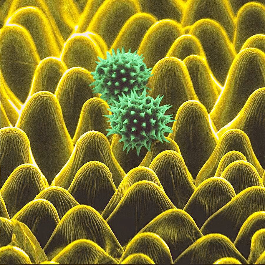 sunflower petal surface and sunflower pollen grains under an electron microscope