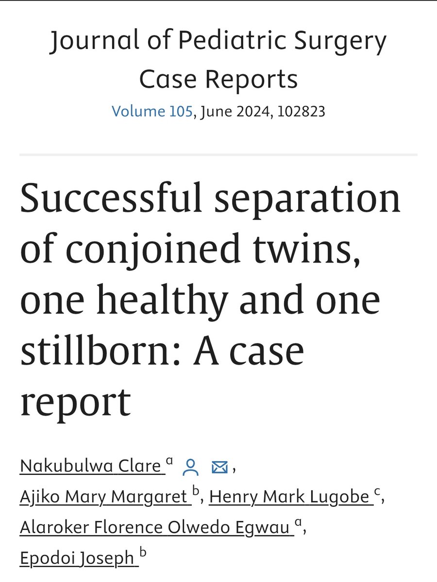 Remember the famous conjoined twins that were successfully separated in Soroti RRH? Story told here by <a href="/ClareBz1/">Clare Bz</a> sciencedirect.com/science/articl… It is still not clear why our super specialised unit with pead surgeons didn't work on this case <a href="/ElsevierConnect/">Elsevier</a> <a href="/KidsOperating/">Kids Operating Room</a> <a href="/stellahalyce/">stellah alice</a>