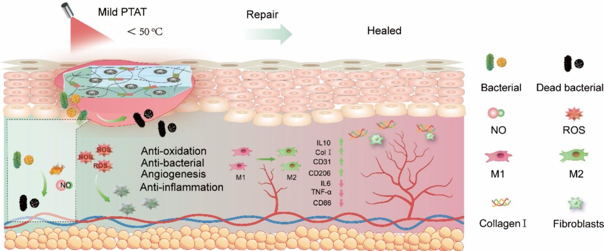 A hyaluronic acid hydrogel as a mild photothermal antibacterial, antioxidant, and nitric oxide release platform for diabetic wound healing.
| Bin Yan @SCUCN |
#hydrogel #HyaluronicAcid #NitricOxide #WoundHealing
doi.org/10.1016/j.jcon…