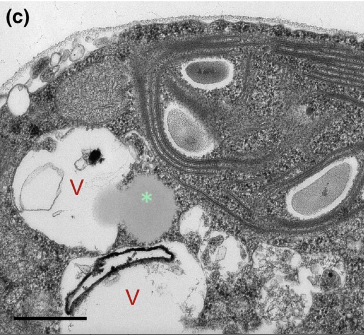 Crespo lab (@chlamyautophagy) on Twitter photo Thrilled to see our new paper published in <a href="/NewPhyt/">New Phytologist</a> ! We describe #lipophagy #autophagy in the new extremophilic microalga Chlamydomonas urium, isolated from the source of the Tinto river (Nerva, Spain). doi.org/10.1111/nph.19… Thrilled to see our new paper published in <a href="/NewPhyt/">New Phytologist</a> ! We describe #lipophagy #autophagy in the new extremophilic microalga Chlamydomonas urium, isolated from the source of the Tinto river (Nerva, Spain). doi.org/10.1111/nph.19…